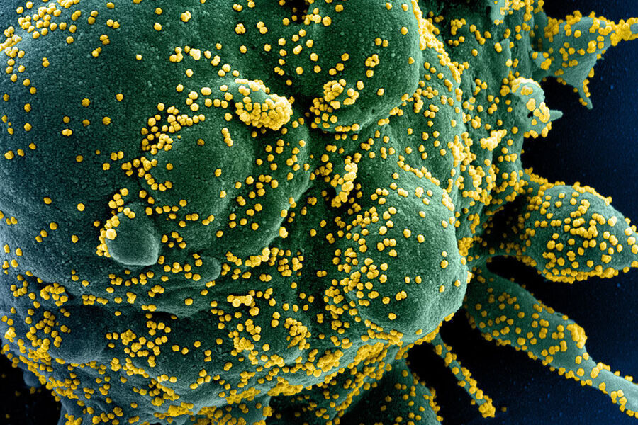 Ilustração do coronavírus pintado de verde-amarelo