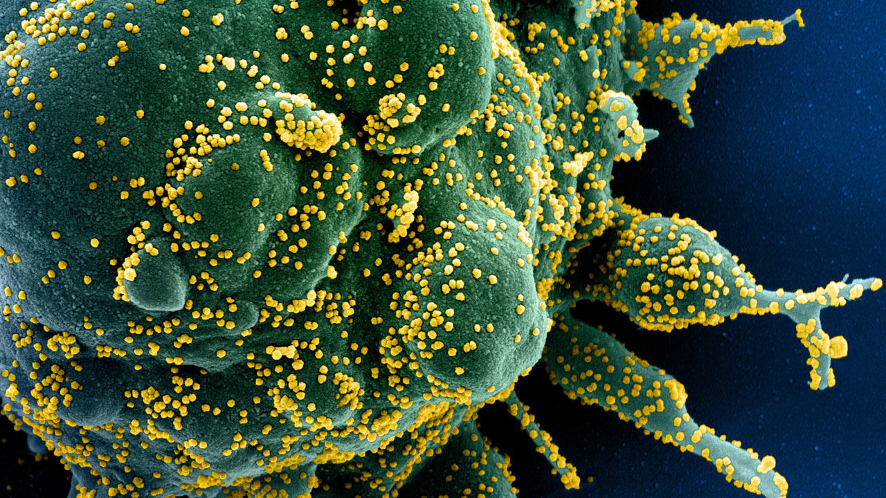 Ilustração da imagem de um coronavírus